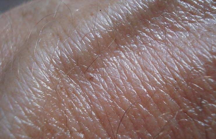 Skin Cancer Myths Debunked: Learn The Truth