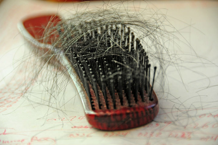Get the Ultimate Hair Loss Treatment for Your Hair, hair loss, hair loss treatment
