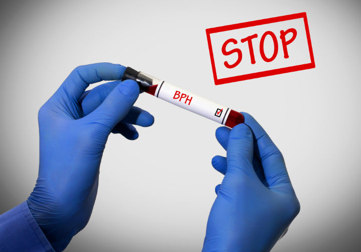 bph drugs, bph treatment, prostate exam, prostate cancer