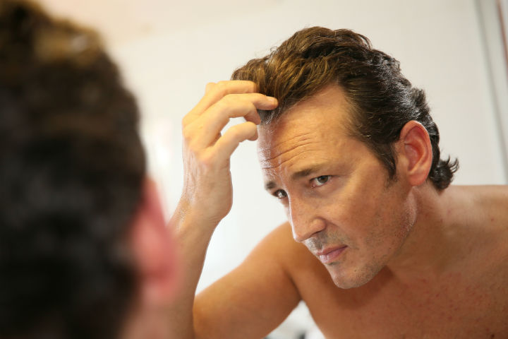 Get the Ultimate Hair Loss Treatment for Your Hair, hair loss, hair loss prevention