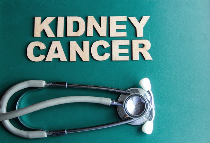 metastatic renal cell carcinoma treatment, renal cell carcinoma diagnosis, metastatic renal cell carcinoma, metastatic renal cell carcinoma treatments, What is Renal Cell Carcinoma Cancer?, metastatic renal carcinoma treatments, metastatic renal cell carcinoma diagnosis, renal cell carcinoma treatment, renal cell carcinoma, alternative kidney cancer treatment, advanced kidney cancer treatments, kidney cancer survival rates, treatment advanced kidney cancer, metastatic kidney cancer treatments, treatment for metastatic kidney cancer