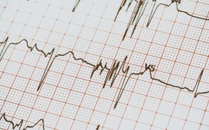 afib valsartan medications