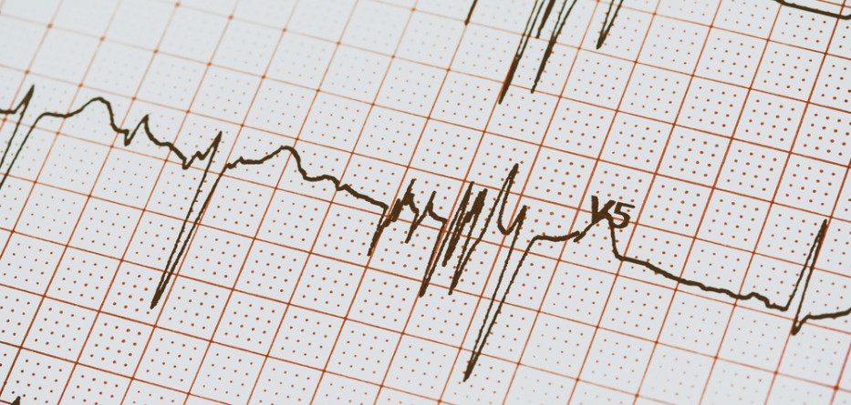 afib valsartan medications