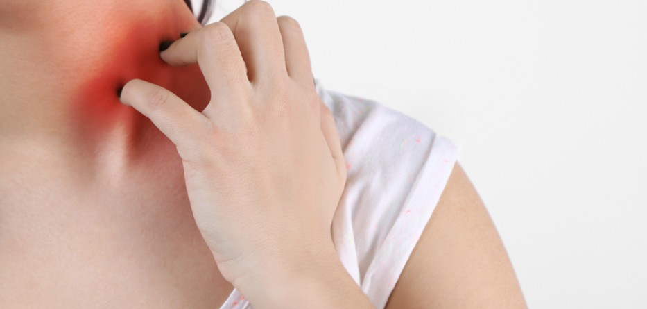 Severe Eczema Treatment