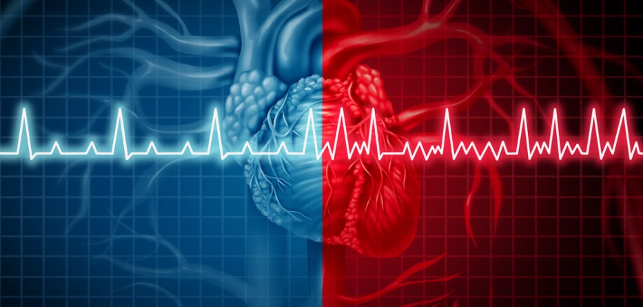 AFib: Everything You Need to Know