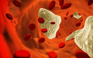 Statin Medicine for Cholesterol