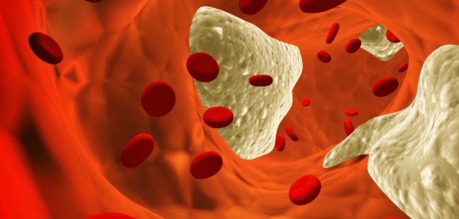 Statin Medicine for Cholesterol