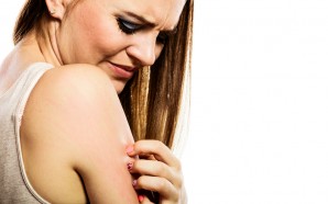atopic eczema treatments