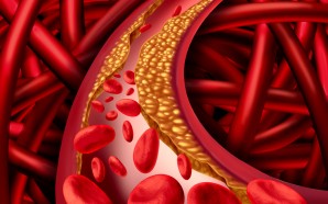 LIVALO lowering ldl cholesterol