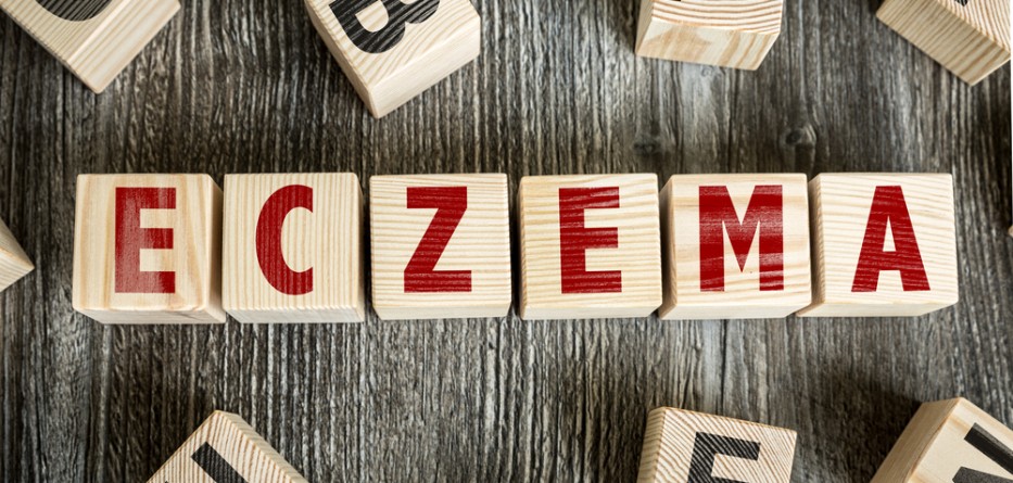 chronic eczema treatment