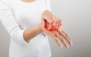 atopic dermatitis hand treatment