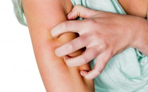 atopic dermatitis treatment options