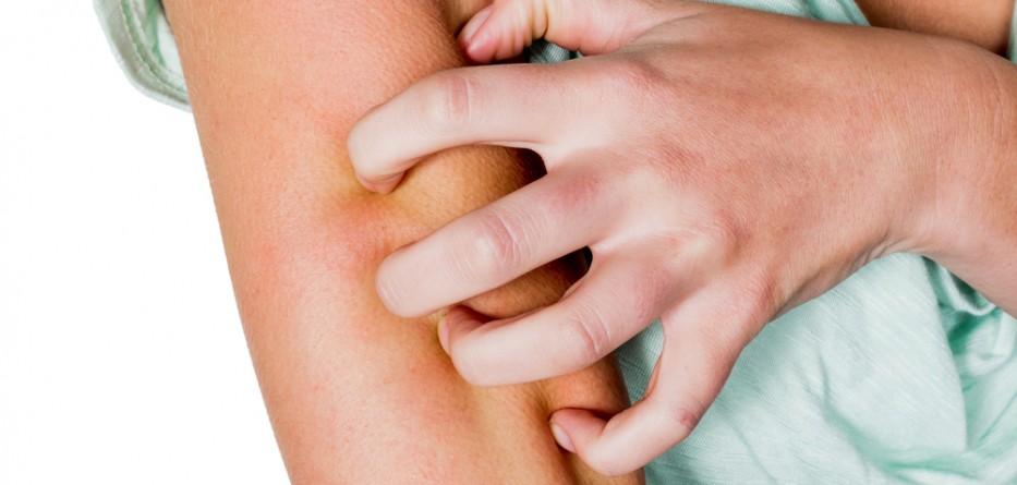 atopic dermatitis treatment options