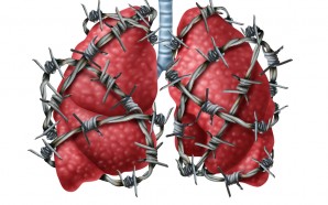 pulmonary fibrosis management