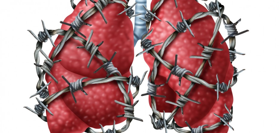 pulmonary fibrosis management